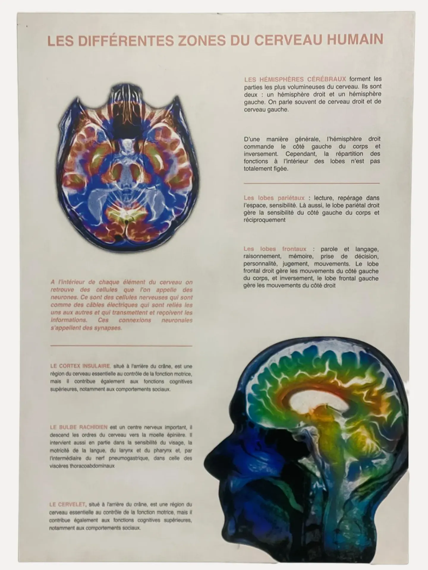 Brain Anatomy Educational Chart