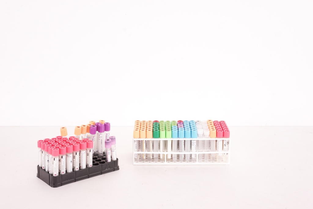 Color-Coded Lab Test Tubes in Plastic Racks